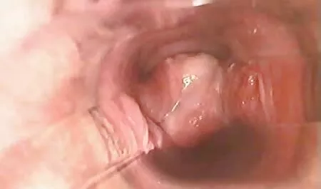 Dvije fre porno hd djevojke za pušenje jebaju troje s momkom i usisavaju kurac